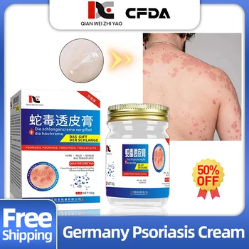 Almanya Sedef bakım kremi Dermatit Mantar Anti-Kaşıntı Cilt Egzama Onarım Yılan Zehiri Merhem Doğal Bitkisel Ilaç